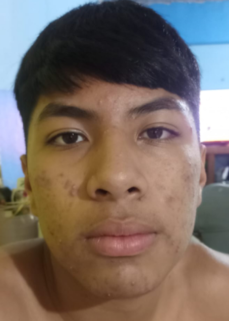 Dilan Azael cruz García